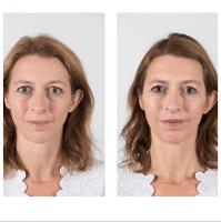 Fiona Clossick Facial Aesthetics image 1